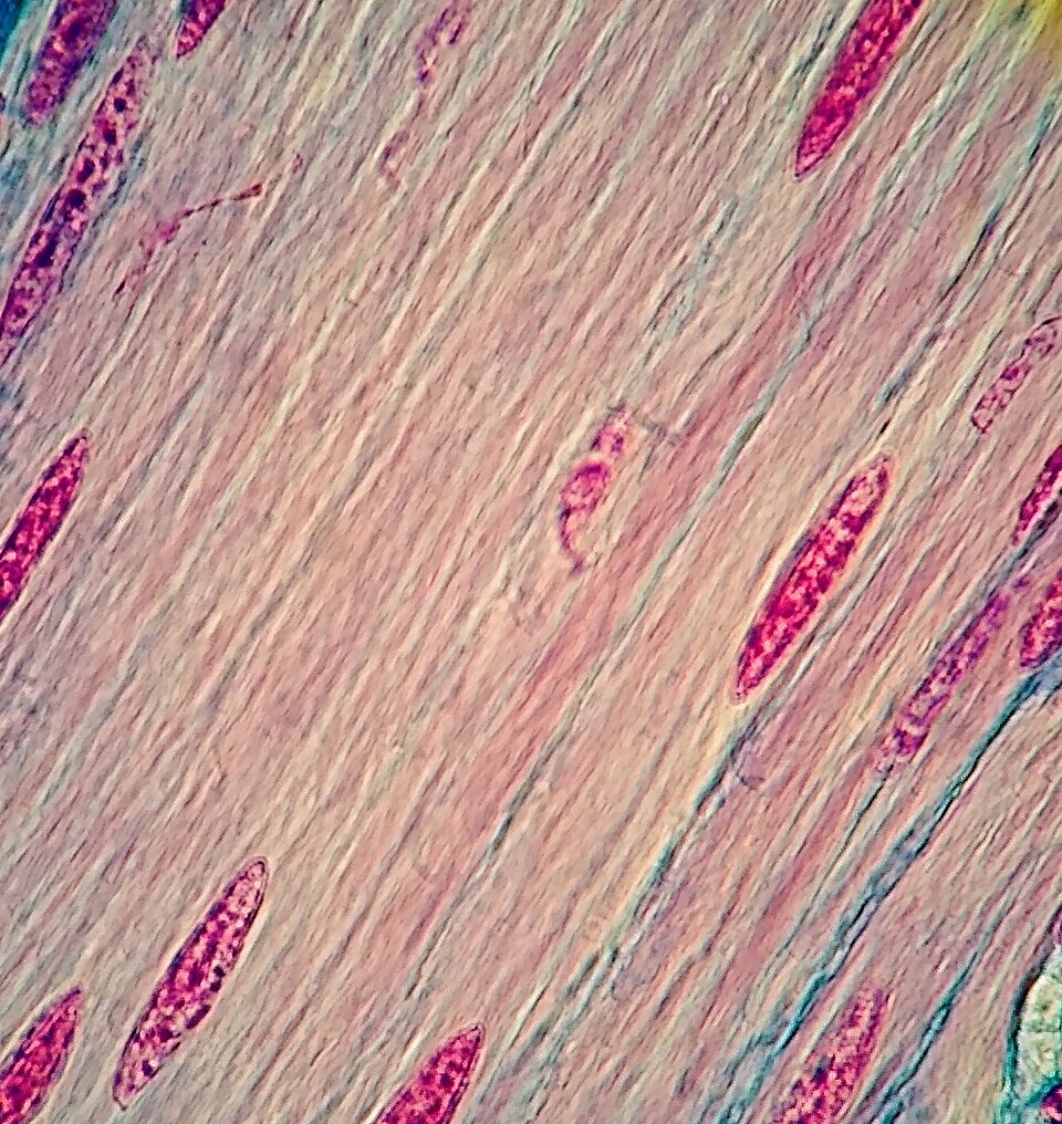 DISTROFIA DI DUCHENNE: NUOVE SCOPERTE SUL RUOLO DEL MICROBIOTA INTESTINALE